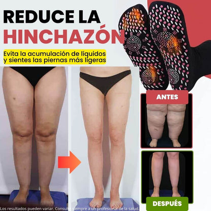 Calcetines de Acupresión Anti-Varices - Alivio al instante