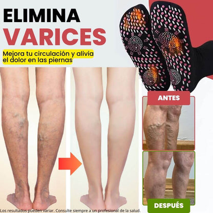 Calcetines de Acupresión Anti-Varices - Alivio al instante