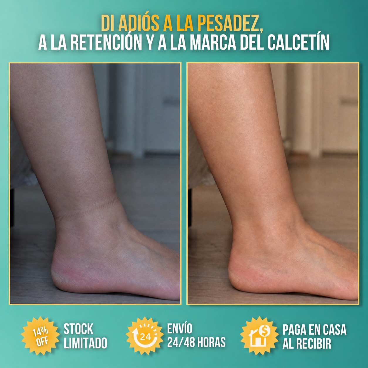 MASAJEADOR ANTICELULITIS | ALUREX™ - Piel mas definida ✨